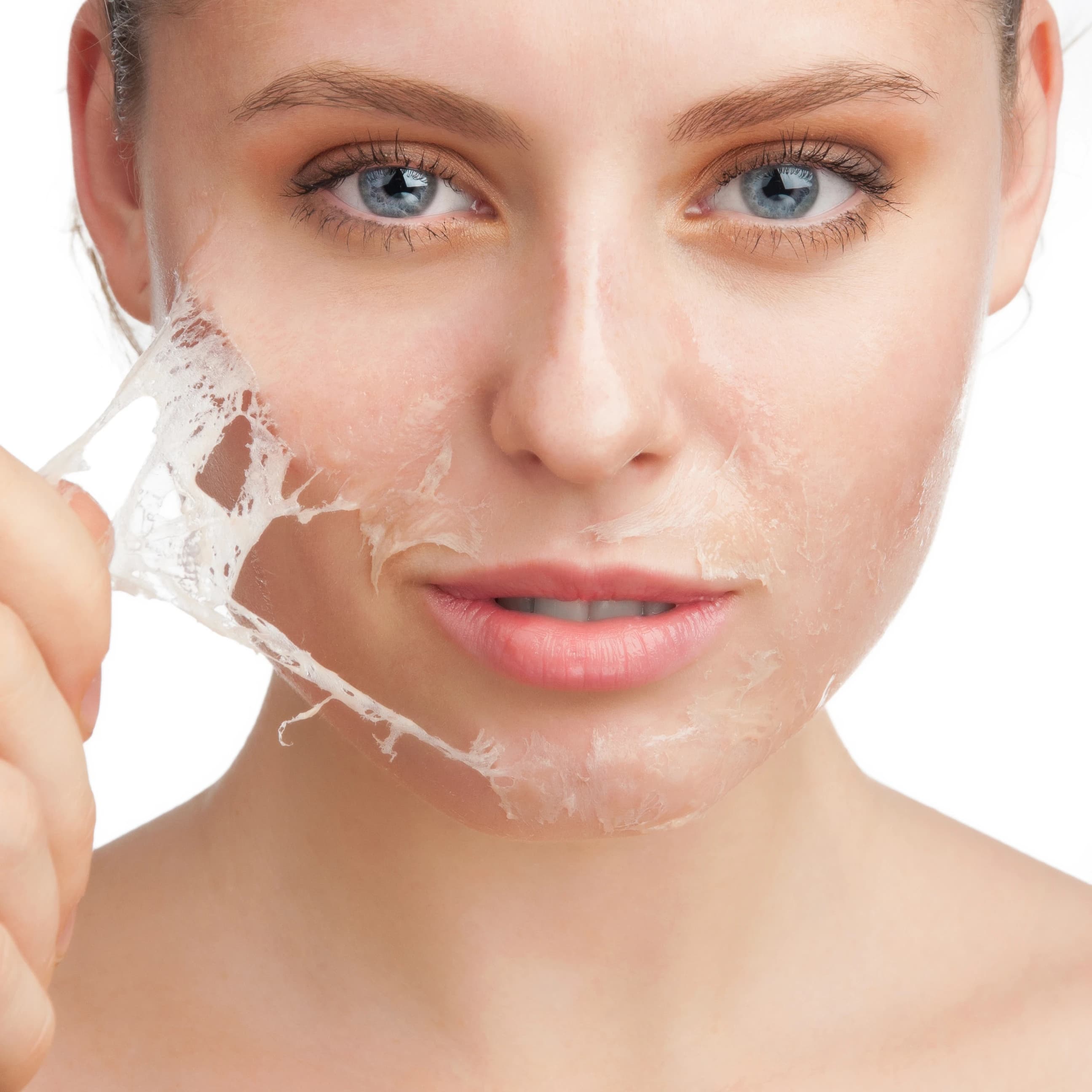 Professional Skin Peel Dublin Treatment at Gerka Clinic