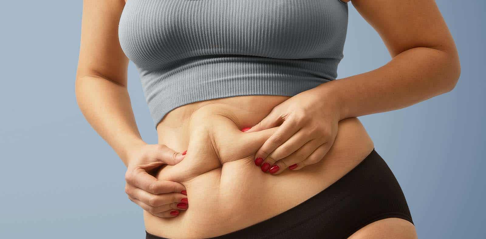 Stubborn Fat Areas