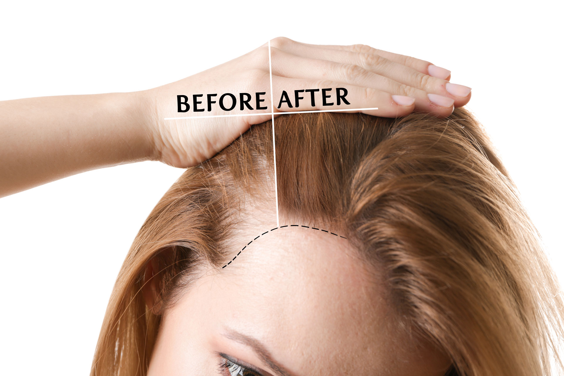 HydraFacial Clinical Detail